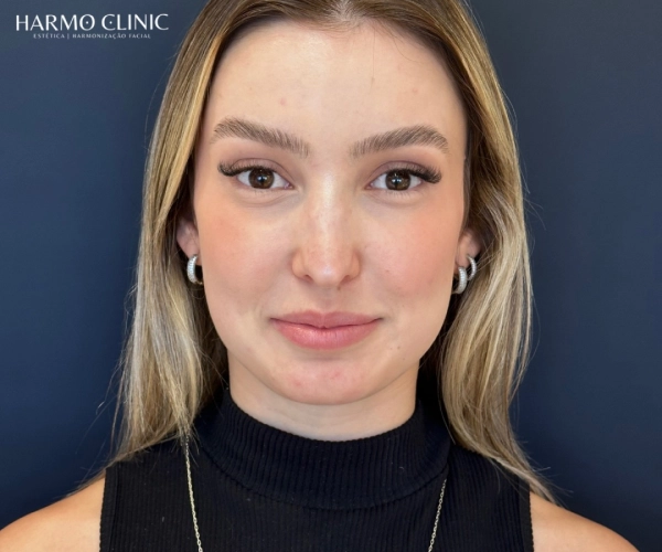 Clinic Harmo Clínica de Estética em Santa Maria RS